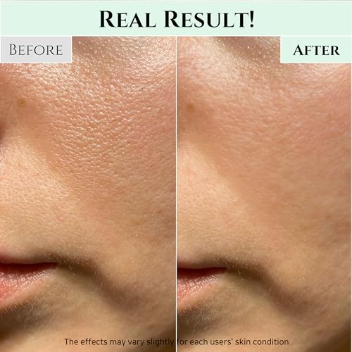 Beauty of Joseon Green Plum Refreshing Cleanser Gel Type Deep Pore Cleansing, Acne Face Wash, Blackhead Remover for All Skin Types, Korean Skincare 100ml, 3.38 fl.oz Beauty of Joseon Green Plum Refreshing Cleanser Gel Type Deep Pore Cleansing, Acne Face Wash, Blackhead Remover for All Skin Types, Korean Skincare 100ml, 3.38 fl.oz
