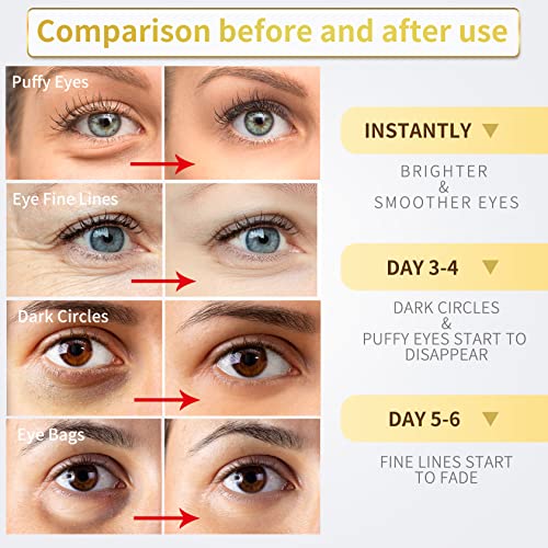 Under Eye Patches - 60 Pcs - 24K Gold Eye Mask- Puffy Eyes & Dark Circles Treatments,Reduce Under Eye Bags and Smooth Wrinkles,Eye Skin Care Pads With Collagen,Hyaluronic Acid &...