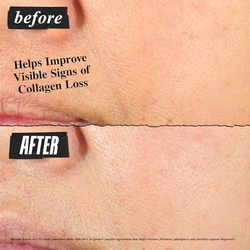 Kiehl's Super Multi-Corrective Cream, Anti-Aging Wrinkle Reducing Face and Neck Cream, Evens Skin Tone, Smooths Skin Texture, Fast-Absorbing and Lightweight, For All Skin Types,...